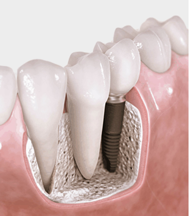 鹽城市艾美萊口腔醫(yī)療有限公司