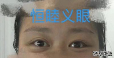 廣東深圳市恒睦義眼醫(yī)療器材康復(fù)輔助有限公司