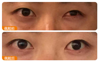 石家莊圓目義眼醫(yī)療科技有限公司